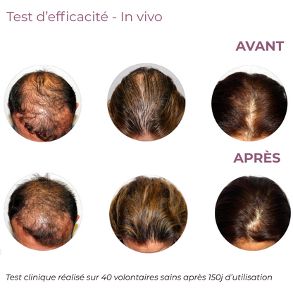 Test clinique avant et après 150 jours d'utilisation du shampooing antichute ERYAM